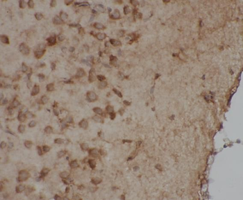 UCHL1 Mouse Monoclonal Antibody