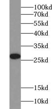 UCHL1 Rabbit Polyclonal Antibody