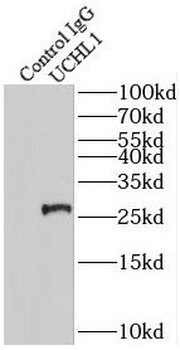 UCHL1 Rabbit Polyclonal Antibody