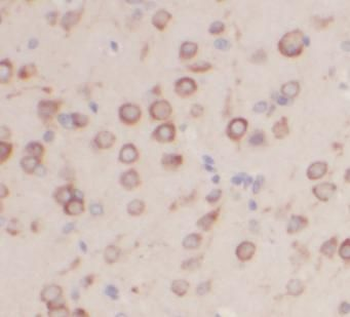 UCHL1 Rabbit Polyclonal Antibody