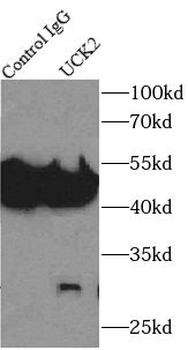 UCK2 Rabbit Polyclonal Antibody