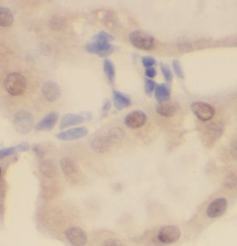 UCKL1 Rabbit Polyclonal Antibody