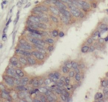 UCP3 Rabbit Polyclonal Antibody