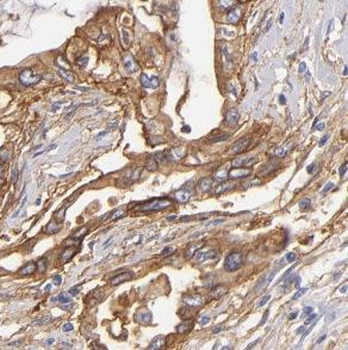 UGGT1 Rabbit Polyclonal Antibody