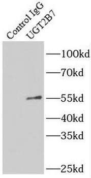 UGT2B7 Rabbit Polyclonal Antibody