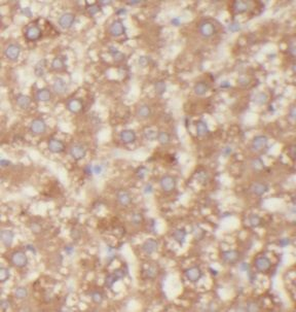 UGT2B7 Rabbit Polyclonal Antibody