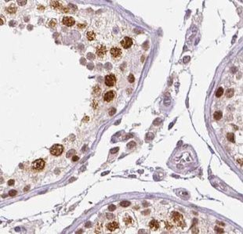 UIMC1 Rabbit Polyclonal Antibody