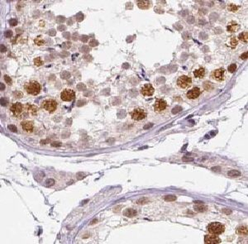 UPF3A Rabbit Polyclonal Antibody