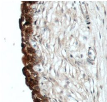 UPK2 Rabbit Polyclonal Antibody