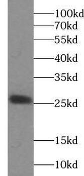 UQCRFS1 Rabbit Polyclonal Antibody