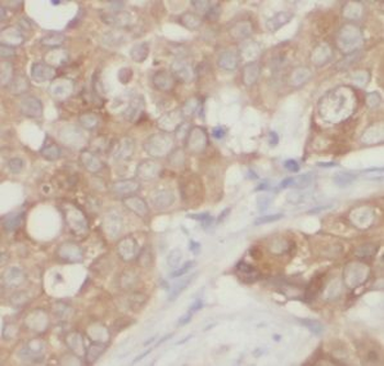 UQCRH Antibody