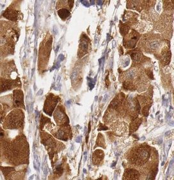 URM1 Rabbit Polyclonal Antibody
