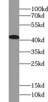 UROD Antibody