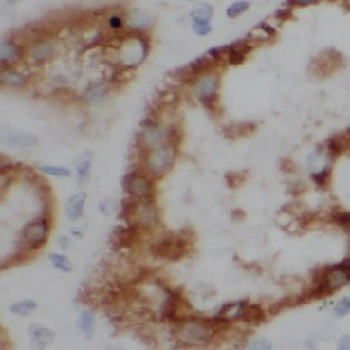 GUCA2B Rabbit Polyclonal Antibody
