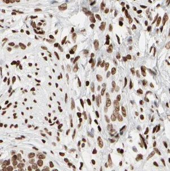 USP1 Rabbit Polyclonal Antibody