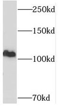 USP11 Antibody