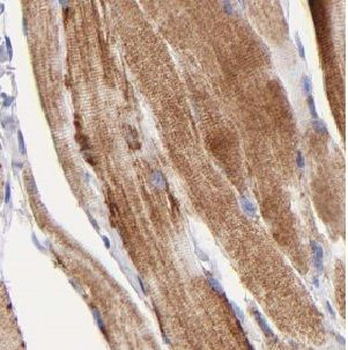 USP2 Rabbit Polyclonal Antibody
