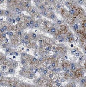 USP2 Rabbit Polyclonal Antibody