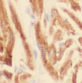 USP21 Rabbit Polyclonal Antibody