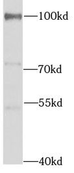 UVRAG Rabbit Polyclonal Antibody