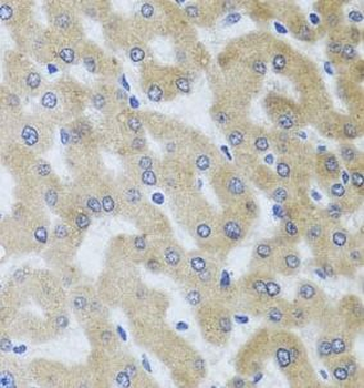 UVRAG Rabbit Polyclonal Antibody