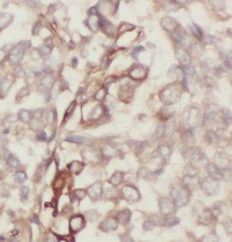 VAMP5 Rabbit Polyclonal Antibody