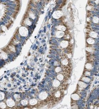 VAMP7 Rabbit Polyclonal Antibody