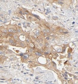 VAPB Rabbit Polyclonal Antibody