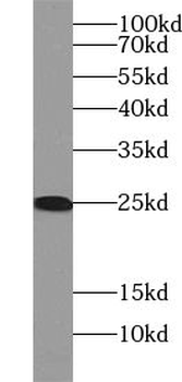 VBP1 Antibody