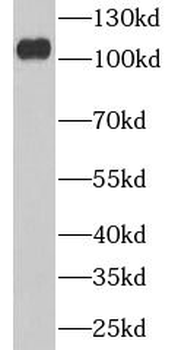 VCP Rabbit Polyclonal Antibody