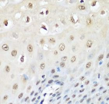 VCP Rabbit Polyclonal Antibody