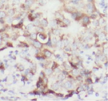 VCPIP1 Rabbit Polyclonal Antibody