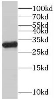VDAC1 antibody