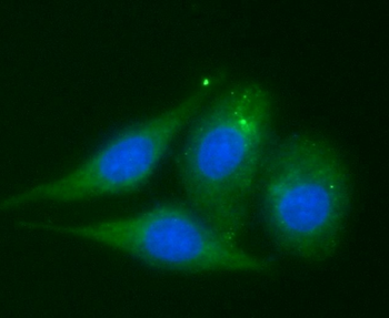 VDAC1 Rabbit Polyclonal Antibody