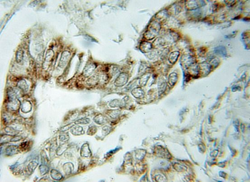 VDAC1 Rabbit Polyclonal Antibody