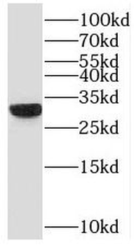 VDAC3 Rabbit Polyclonal Antibody