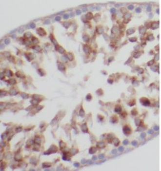VDAC3 Rabbit Polyclonal Antibody