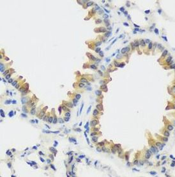 FLT4 Rabbit Polyclonal Antibody