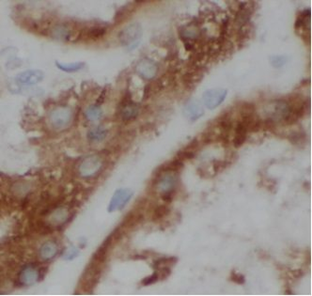 VHL Rabbit Polyclonal Antibody