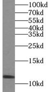VMA21 Antibody