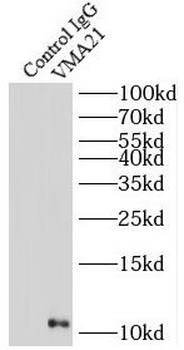 VMA21 Rabbit Polyclonal Antibody