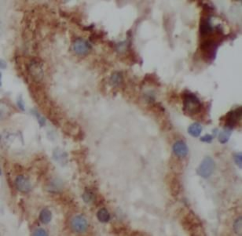 VMA21 Rabbit Polyclonal Antibody