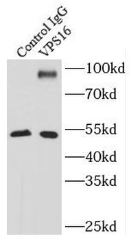 VPS16 Rabbit Polyclonal Antibody