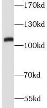 VPS18 Antibody
