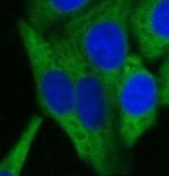 CHMP3 Rabbit Polyclonal Antibody
