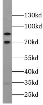 VPS52 Antibody