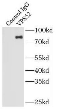 VPS52 Rabbit Polyclonal Antibody