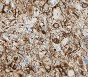 VPS52 Rabbit Polyclonal Antibody