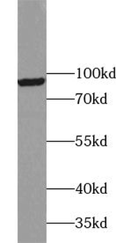 VPS53 Antibody