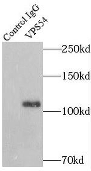 VPS54 Rabbit Polyclonal Antibody